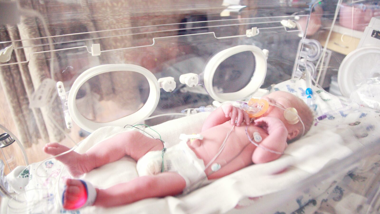A newborn lying in a hospital incubator