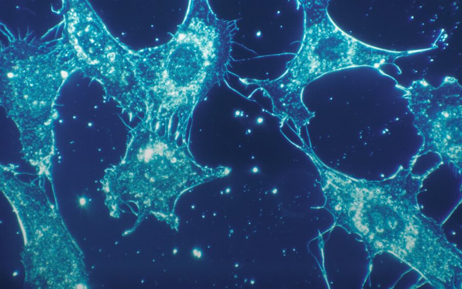 Human cells glowing under a fluorescence microscope
