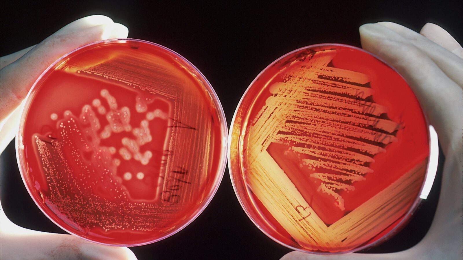 Gloved hands holding a petri dish in a laboratory