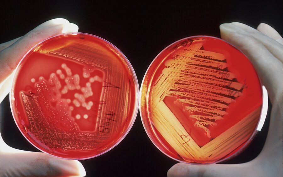 Gloved hands holding a petri dish in a laboratory