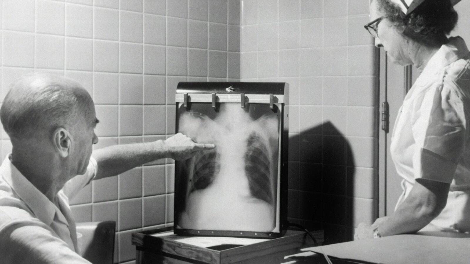 Clinicians reviewing a chest X-ray