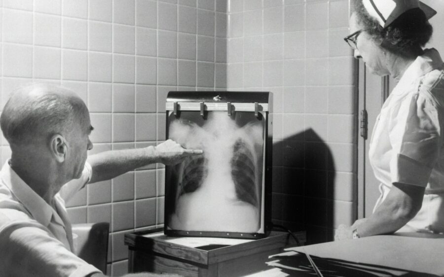 Clinicians reviewing a chest X-ray