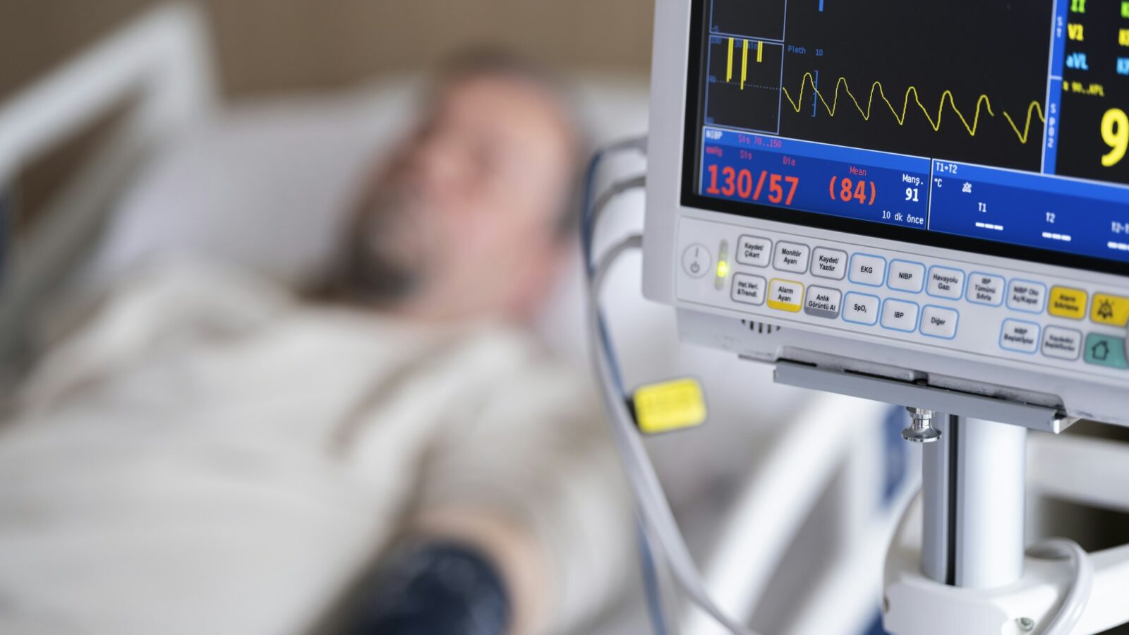 A patient in a hospital bed beside a monitor